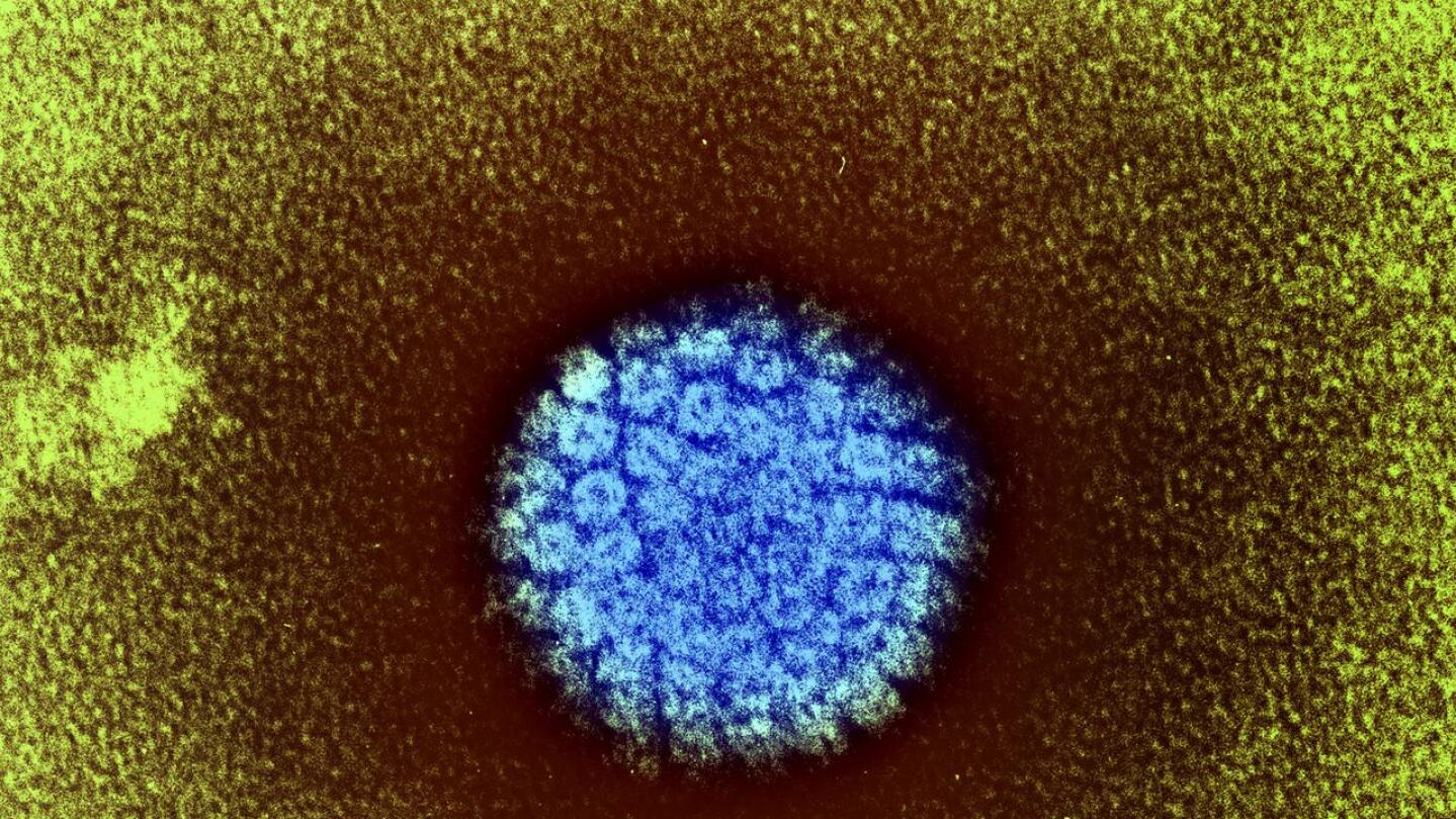 Tältä näyttää HPV-virus.